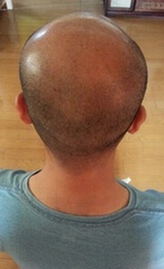 チャップアップ体験レポート