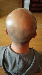 チャップアップ体験レポート