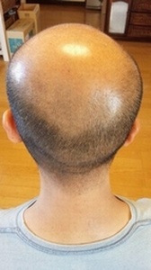 チャップアップ体験レポート